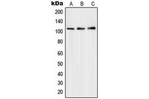 Western blot analysis of PMS1 expression in HepG2 (A), Molt4 (B), A549 (C) whole cell lysates. (PMS1 antibody  (Center))