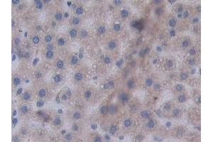 Detection of STAT2 in Rat Liver Tissue using Polyclonal Antibody to Signal Transducer And Activator Of Transcription 2 (STAT2) (STAT2 antibody  (AA 587-838))