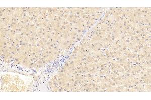 Detection of AT in Human Liver Tissue using Monoclonal Antibody to Antithrombin (AT) (SERPINC1 antibody)