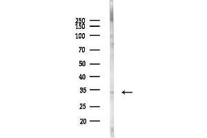 anti-Golgi phosphoprotein 3 (Coat-Protein) (GOLPH3) (C-Term) antibody