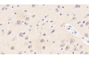 Detection of EFNA3 in Human Cerebrum Tissue using Polyclonal Antibody to Ephrin A3 (EFNA3) (Ephrin A3 antibody  (AA 30-238))