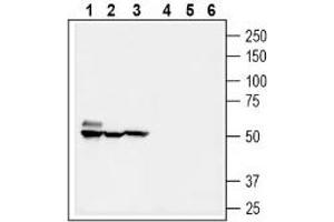 Western blot analysis of mouse brain lysate (lanes 1 and 4), rat kidney membranes (lanes 2 and 5) and mouse colon membranes (3 and 6): - 1-3. (SLC5A8 antibody  (C-Term, Intracellular))