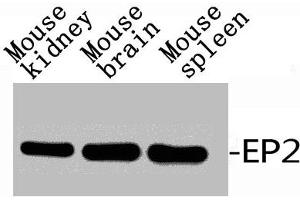 Western Blot analysis of RAT-KIDNEY MOUSE-BRAIN MOUSE-HEART using EP2 Polyclonal Antibody. (PTGER2 antibody  (C-Term))