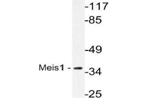 Western blot (WB) analysis of Meis1 antibody in extracts from Jurkat cells.