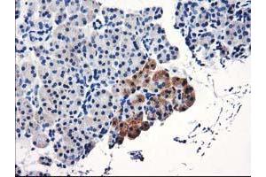 Immunohistochemical staining of paraffin-embedded Human pancreas tissue using anti-TBC1D21 mouse monoclonal antibody. (TBC1D21 antibody)