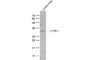 Mouse lymph Node lysates probed with LYVE-1 Polyclonal Antibody, Unconjugated  at 1:300 dilution and 4˚C overnight incubation. (LYVE1 antibody  (AA 51-150))