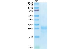 SDS-PAGE (SDS) image for Cytotoxic T-Lymphocyte-Associated Protein 4 (CTLA4) (AA 37-160) protein (His tag) (ABIN7274434)
