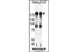 Western blot analysis of EGFR in Hela cell lysates, either induced (Lane 1) or noninduced with EGF (Lane 2).