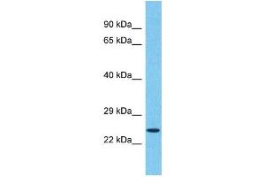 Western Blotting (WB) image for anti-Transmembrane Emp24 Protein Transport Domain Containing 5 (TMED5) (C-Term) antibody (ABIN2791940) (TMED5 antibody  (C-Term))