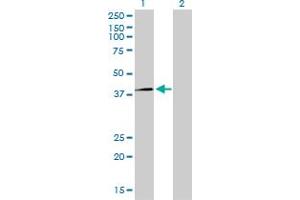Western Blotting (WB) image for anti-Replication Factor C (Activator 1) 4, 37kDa (RFC4) (AA 254-363) antibody (ABIN562635)