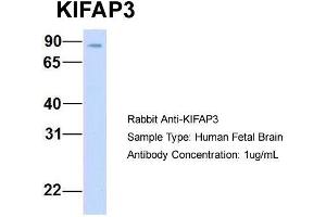 Host: Rabbit  Target Name: KIFAP3  Sample Tissue: Human Fetal Brain  Antibody Dilution: 1. (KIFAP3 antibody  (Middle Region))