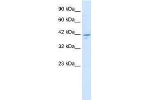 Human HepG2; WB Suggested Anti-ZNF237 Antibody Titration: 1. (ZMYM5 antibody  (N-Term))