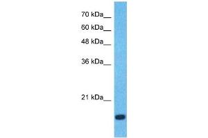 Host:  Rabbit  Target Name:  CCL18  Sample Type:  Fetal Lung lysates  Antibody Dilution:  0. (CCL18 antibody  (Middle Region))