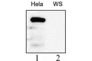 WRN antibody (mAb) tested by Western blot. (RECQL2 antibody)