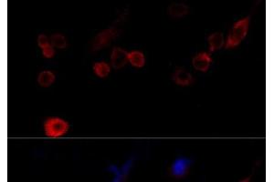 Immunofluorescence (IF) image for anti-Filamin A, alpha (FLNA) antibody (ABIN7259092)