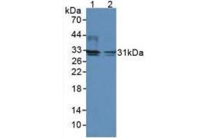 Figure. (DIO2 antibody  (AA 30-259))
