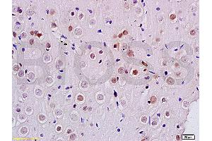 Formalin-fixed and paraffin embedded rat brain labeled with Anti DENTT Polyclonal Antibody, Unconjugated (ABIN722245) at 1:200 followed by conjugation to the secondary antibody and DAB staining (TSPY-Like 2 antibody  (AA 251-350))