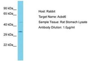 Image no. 1 for anti-Acyl-CoA Binding Domain Containing 6 (ACBD6) (AA 130-179) antibody (ABIN6750442) (ACBD6 antibody  (AA 130-179))