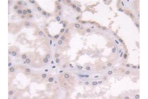 Immunohistochemistry (IHC) image for anti-Cellular Retinoic Acid Binding Protein 2 (CRABP2) (AA 1-138) antibody (ABIN7435991)