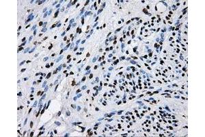 Immunohistochemical staining of paraffin-embedded endometrium tissue using anti-RALBP1mouse monoclonal antibody. (RALBP1 antibody)
