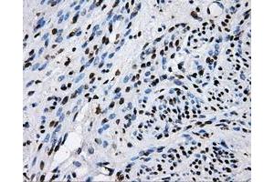Immunohistochemical staining of paraffin-embedded endometrium tissue using anti-RALBP1mouse monoclonal antibody.