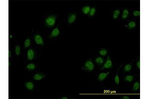 Immunofluorescence of monoclonal antibody to CAND1 on HeLa cell. (CAND1 antibody  (AA 1-100))