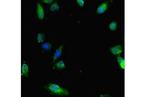 Immunofluorescent analysis of Hela cells using ABIN7160220 at dilution of 1:100 and Alexa Fluor 488-congugated AffiniPure Goat Anti-Rabbit IgG(H+L) (SMAD1 antibody  (AA 150-250))
