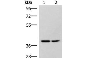 Western blot analysis of Hela and 231 cell lysates using HPDL Polyclonal Antibody at dilution of 1:400 (HPDL antibody)