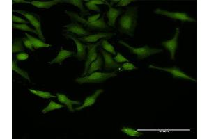 Immunofluorescence of purified MaxPab antibody to TRAF4 on HeLa cell. (TRAF4 antibody  (AA 1-470))