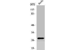 Western Blot analysis of COLO205 cells using Six3/6 Polyclonal Antibody (SIX Homeobox 6 antibody  (Internal Region))