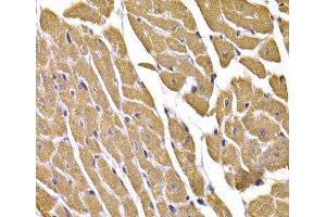 Immunohistochemistry of paraffin-embedded Mouse heart using GLUT4 Polyclonal Antibody at dilution of 1:100 (40x lens). (GLUT4 antibody)