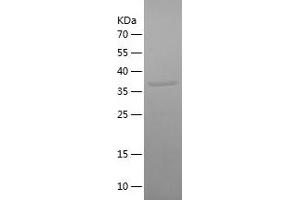 Western Blotting (WB) image for Odontogenic, Ameloblast Asssociated (ODAM) (AA 1-153) protein (His-IF2DI Tag) (ABIN7283573) (ODAM Protein (AA 1-153) (His-IF2DI Tag))