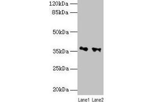 Western blot All lanes: RDH11 antibody at 10 μg/mL Lane 1: PC-3 whole cell lysate Lane 2: Hela whole cell lysate Secondary Goat polyclonal to rabbit IgG at 1/10000 dilution Predicted band size: 36, 35, 28 kDa Observed band size: 36 kDa