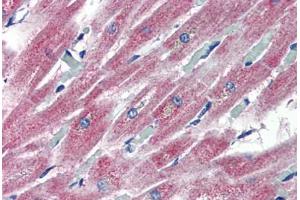 anti-Pleckstrin Homology Domain Containing, Family H (With MyTH4 Domain) Member 2 (PLEKHH2) (AA 1043-1092) antibody