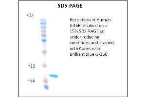 SDS-PAGE (SDS) image for Interleukin 1 eta (FIL1h) (Active) protein (ABIN5509788)