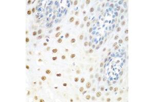 Immunohistochemistry of paraffin-embedded human esophagus using DDX39B antibody. (DDX39B antibody  (AA 319-428))