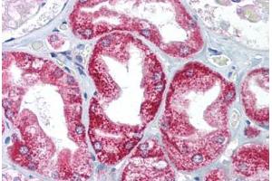 Immunohistochemistry (Paraffin-embedded Sections) (IHC (p)) image for anti-Apoptosis-Inducing Factor, Mitochondrion-Associated, 1 (AIFM1) (AA 211-260) antibody (ABIN6736699)