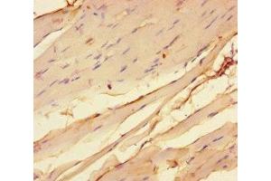 Immunohistochemistry of paraffin-embedded human skeletal muscle tissue using ABIN7142955 at dilution of 1:100 (CHRNA1 antibody  (AA 21-255))