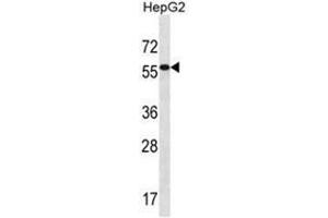 ALDH3B2 Antibody (C-term) western blot analysis in HepG2 cell line lysates (35 µg/lane). (ALDH3B2 antibody  (C-Term))