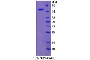 SDS-PAGE analysis of Human RTN1 Protein.