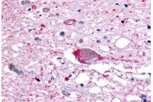 Immunohistochemistry (Formalin/PFA-fixed paraffin-embedded sections) of human brain, neurons and glia with GPR32 polyclonal antibody . (GPR32 antibody  (2nd Extracellular Domain))