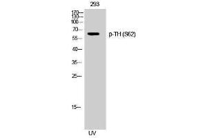 Western Blotting (WB) image for anti-TH (pSer62) antibody (ABIN3180444) (TH antibody  (pSer62))