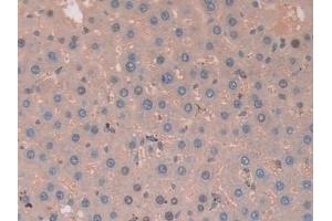 Detection of CA2 in Rat Liver Tissue using Polyclonal Antibody to Carbonic Anhydrase II (CA2) (CA2 antibody  (AA 1-260))