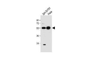 All lanes : Anti-hG5L-D3 at 1:1000 dilution Lane 1: SH-SY5Y whole cell lysate Lane 2: Hela whole cell lysate Lysates/proteins at 20 μg per lane. (ATG5 antibody  (N-Term))