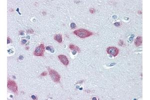 Immunohistochemistry (IHC) image for anti-Phenylalanyl-tRNA Synthetase, beta Subunit (FARSB) (AA 234-342) antibody (ABIN614697) (FARSB antibody  (AA 234-342))