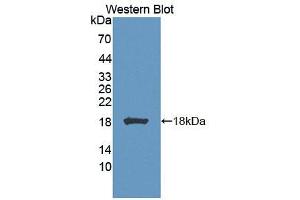 Figure. (Biliverdin Reductase antibody  (AA 1-125))