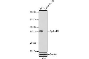 Western blot analysis of extracts from wild type (WT) and Cyclin D1 knockout (KO) HeLa cells, using Cyclin D1 antibody (ABIN7266561) at 1:1000 dilution. (Cyclin D1 antibody)