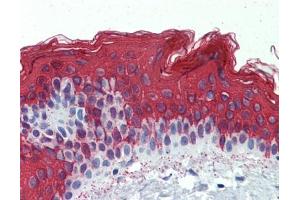 Cytokeratin 1 antibody was used for immunohistochemistry at a concentration of 4-8 ug/ml.