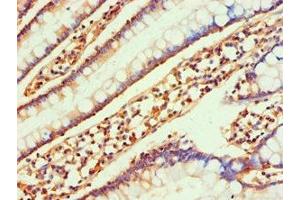 Immunohistochemistry of paraffin-embedded human small intestine tissue using ABIN7145991 at dilution of 1:100 (CCL25 antibody  (AA 24-150))