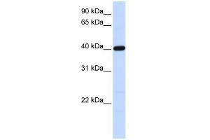 Tropomodulin 3 antibody used at 1 ug/ml to detect target protein.
